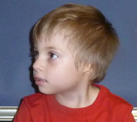 Young boy with microtia